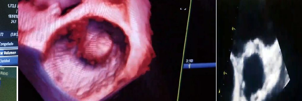 Néstor Leyva banner