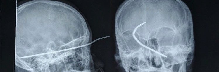 Patrice alexis🇬🇦 banner