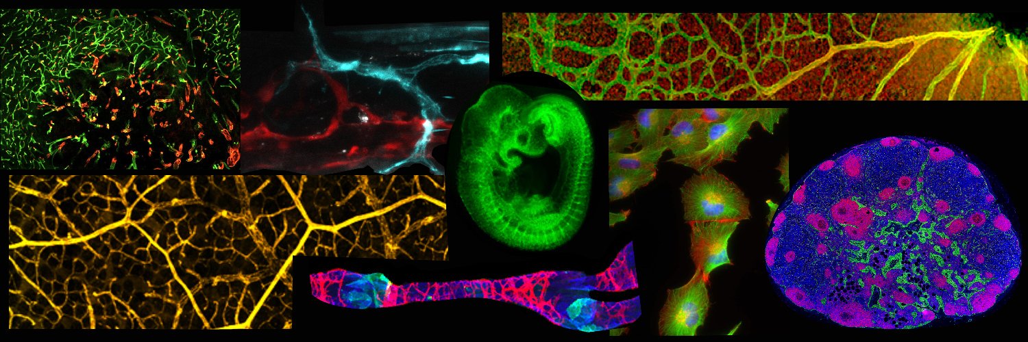 Uppsala Vascular Biology's banner