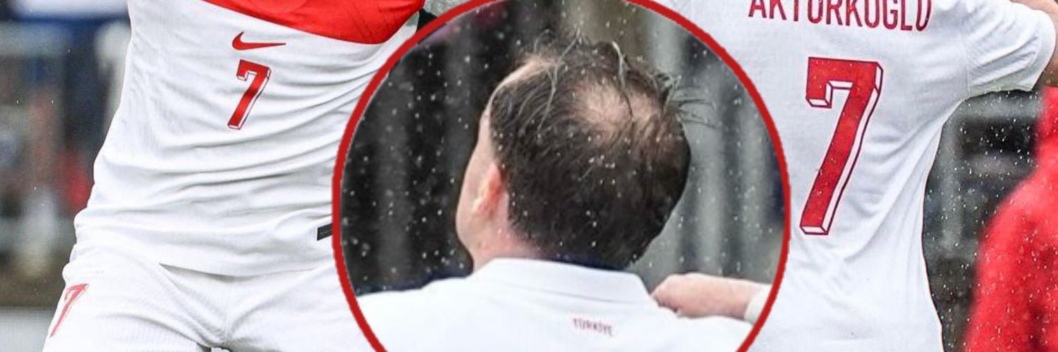 Kerem saç kaybı banner
