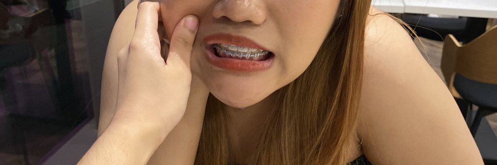 𝐵 banner