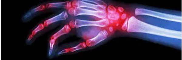 PittRheum Profile Banner