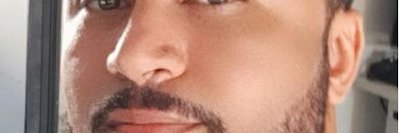 coraaxon banner