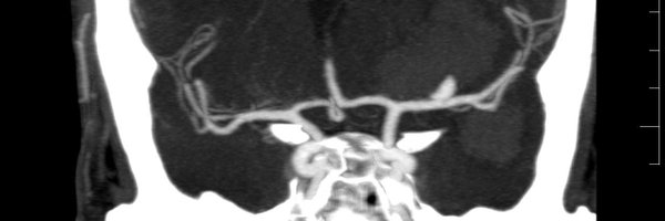 GNeurocriticos Profile Banner