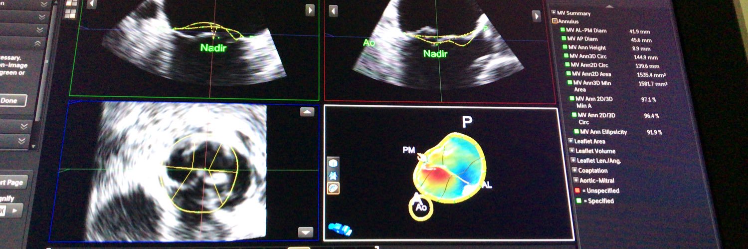 laledincasarcikli banner