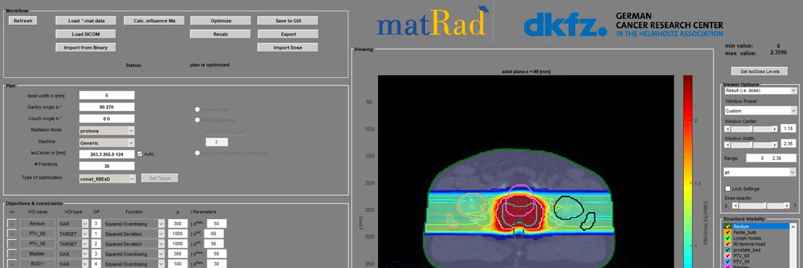 matRad (@mat_rad) / Posts / X