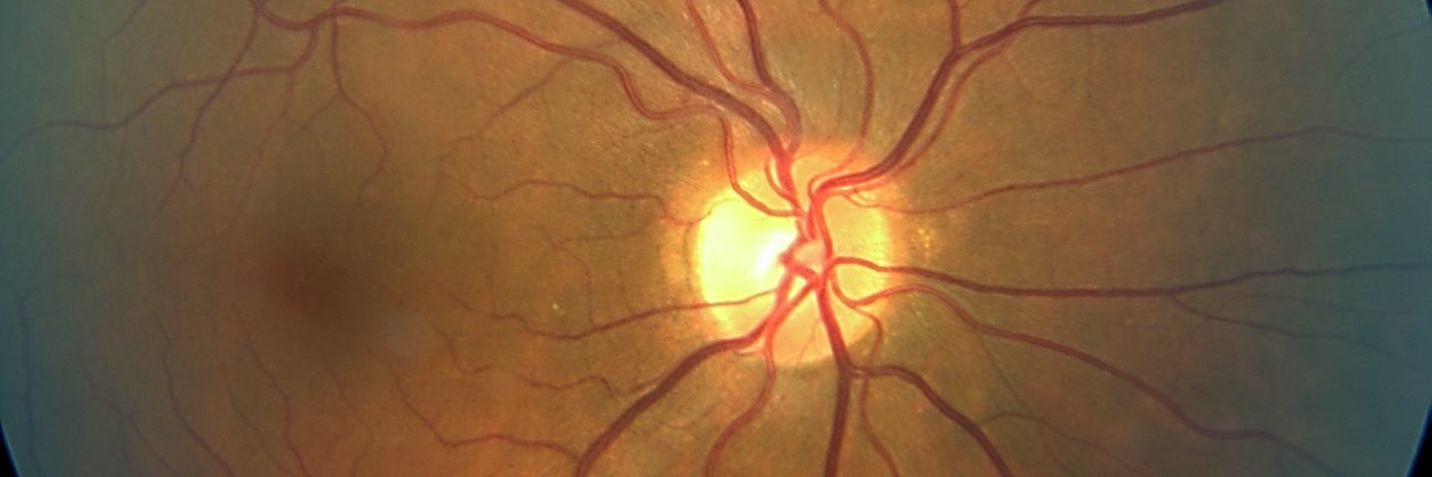 Retina_Search's profile banner image
