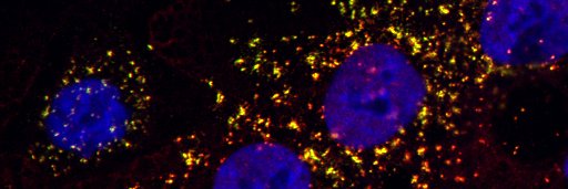 Penn Ctr Research on Coronavirus & Other Emerging banner