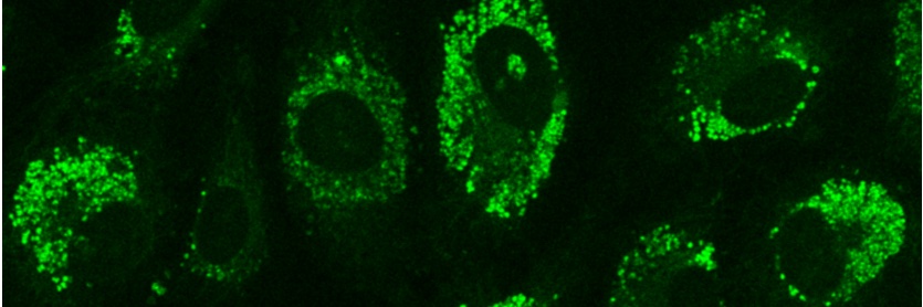 Vascular Metabolism and Inflammation Lab's banner