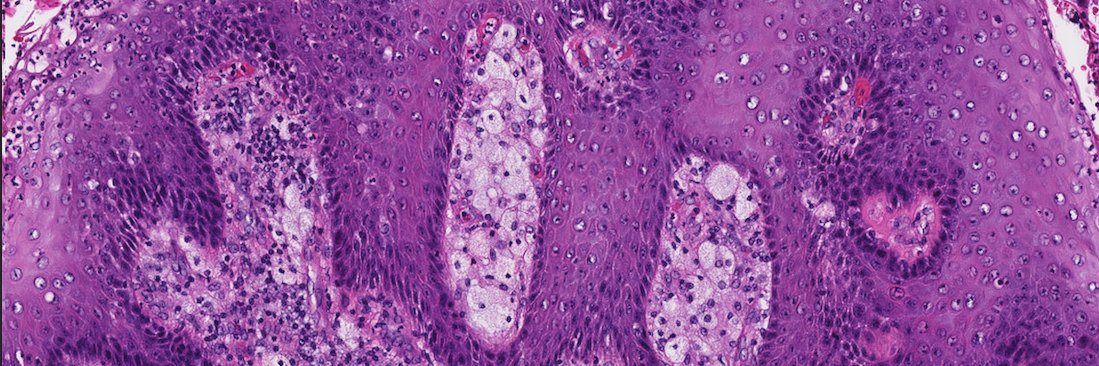 A. Sarah Erem banner