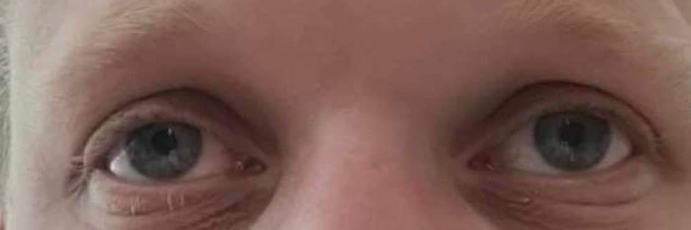 Gauche de Puskas banner