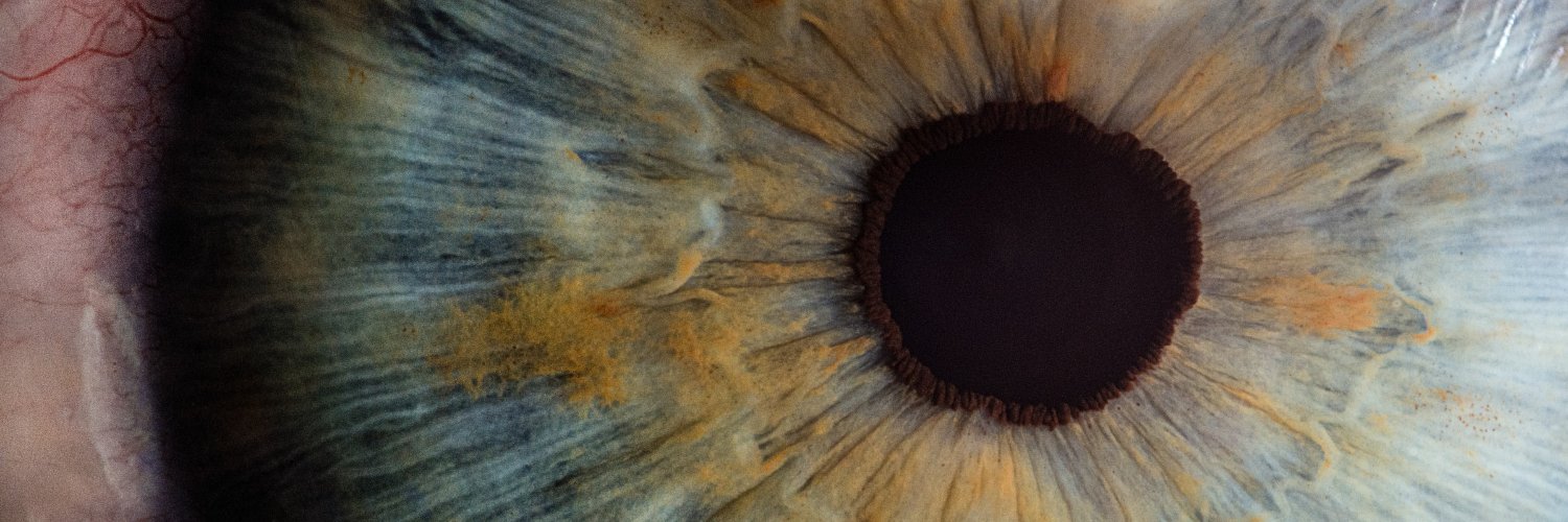 WeOptimeye banner