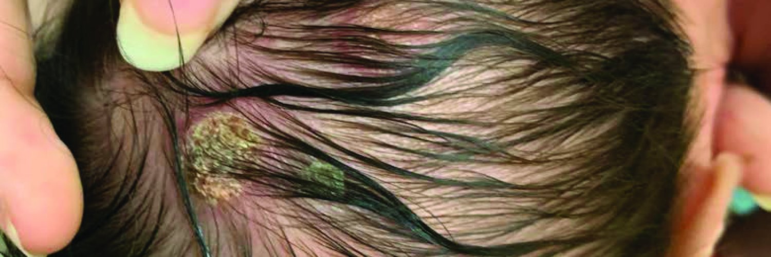 PedsSectionACEP banner