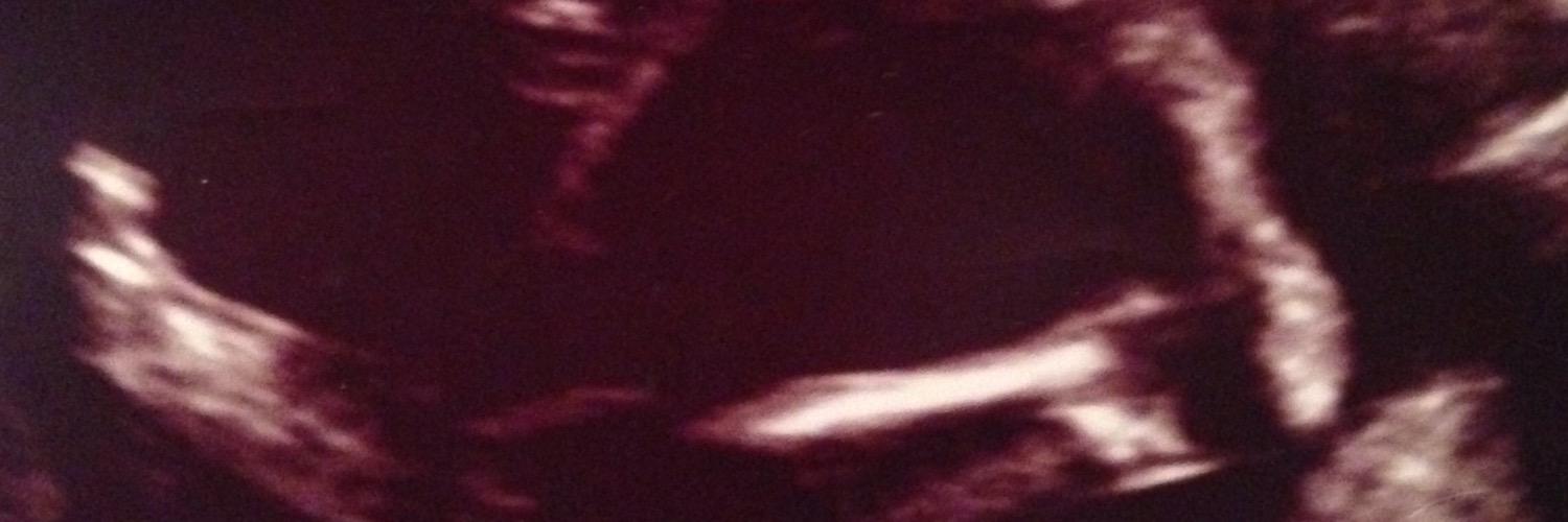 Thuggin_103's profile banner image