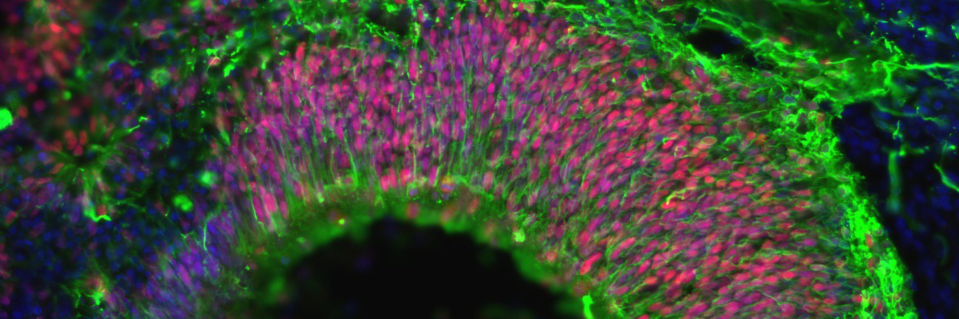 Charlie Arber banner