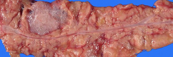 pbpath Profile Banner
