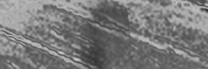REND's banner