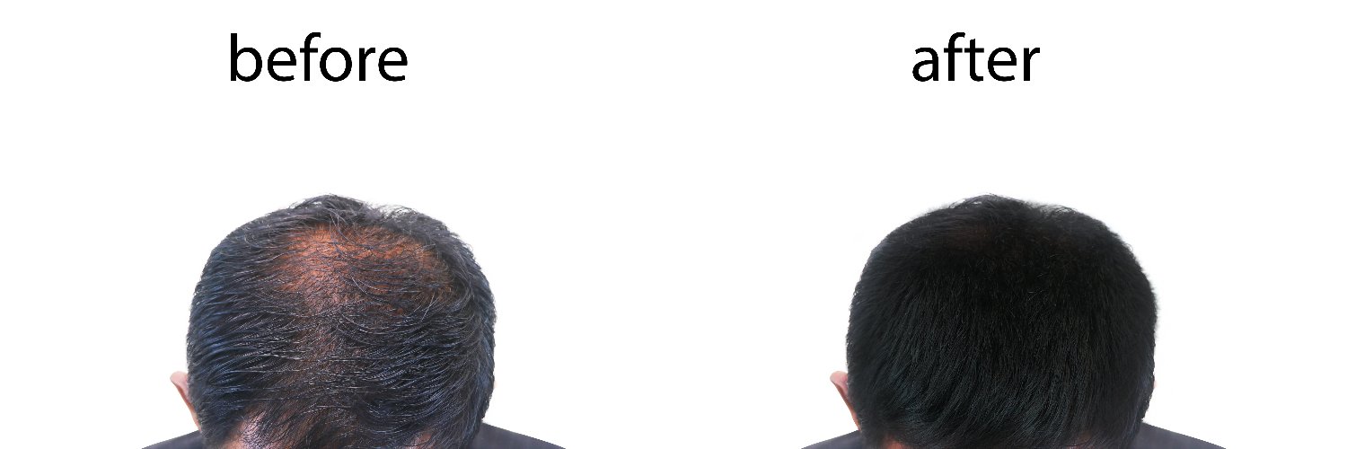 Biofollicle's profile banner image