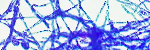Holly Huse, Ph.D., D(ABMM) banner