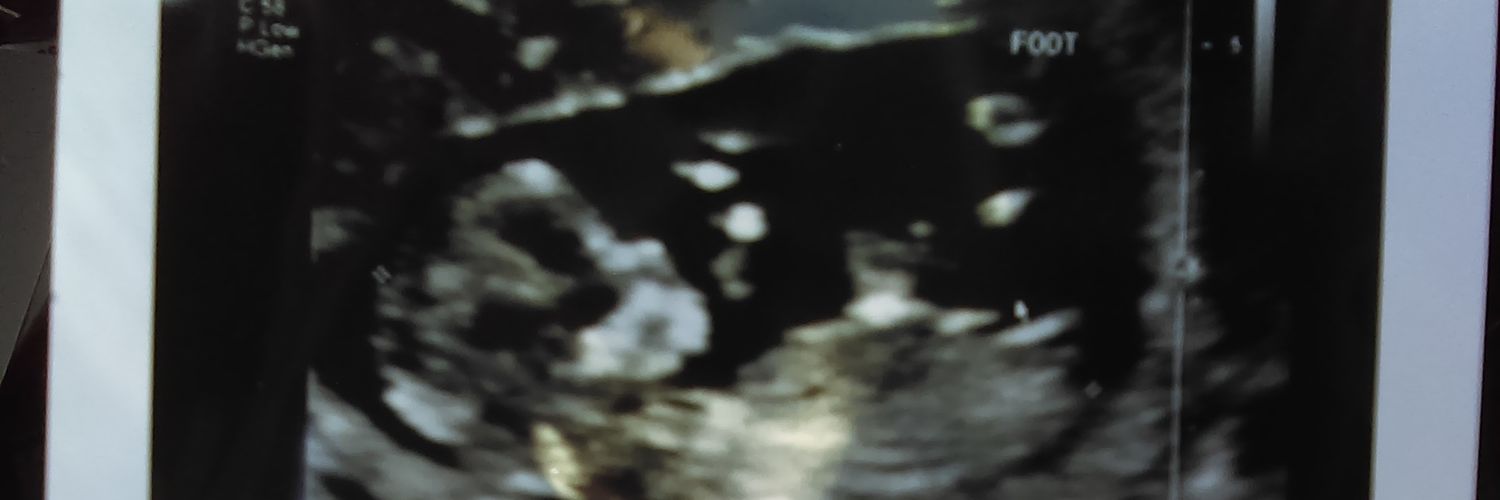 WallerMeghan's profile banner image