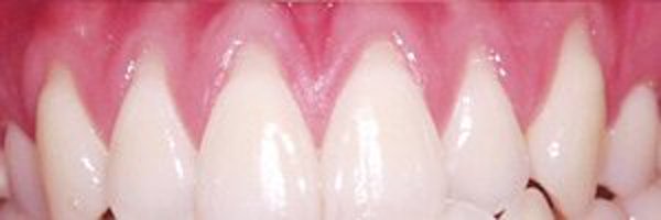 wormy_gums Profile Banner