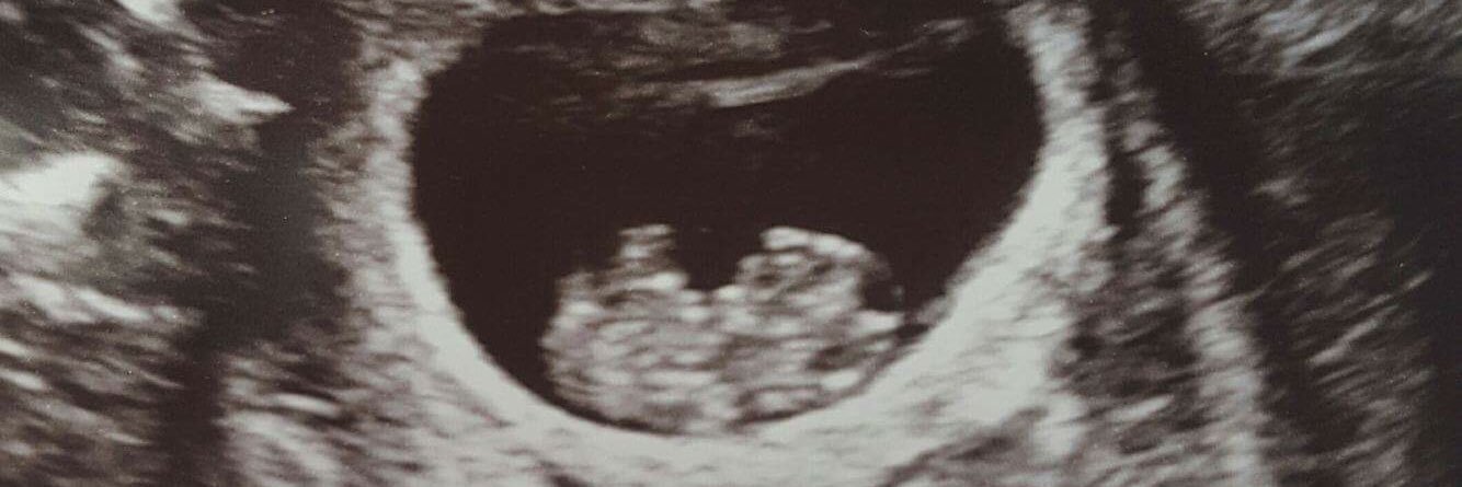 Millie barker banner