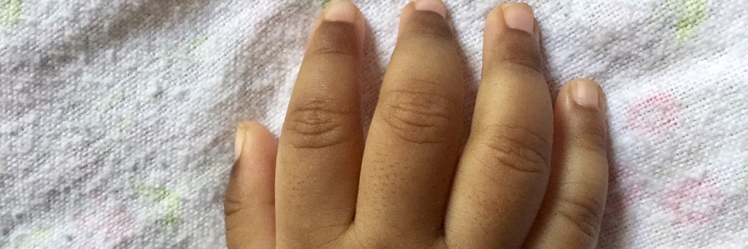 Declopa Kintakunte banner