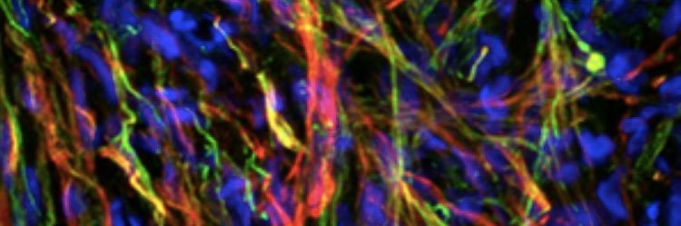 Thomas Schmidt banner