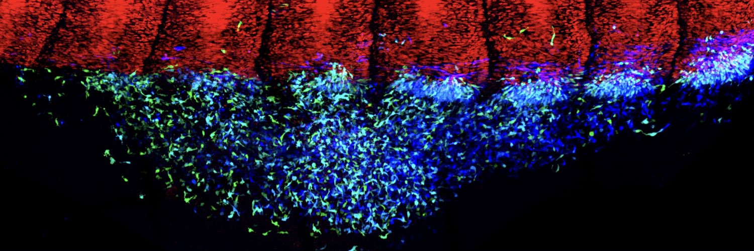 Gauthier Toulouse banner