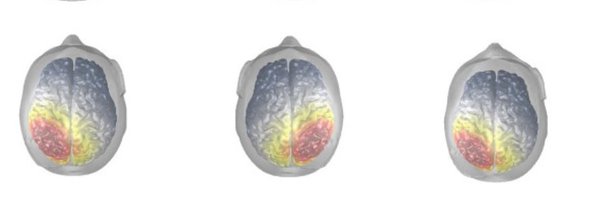 NeuroIMI Profile Banner