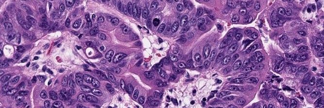 Georgia Association of Pathology (GAP) banner