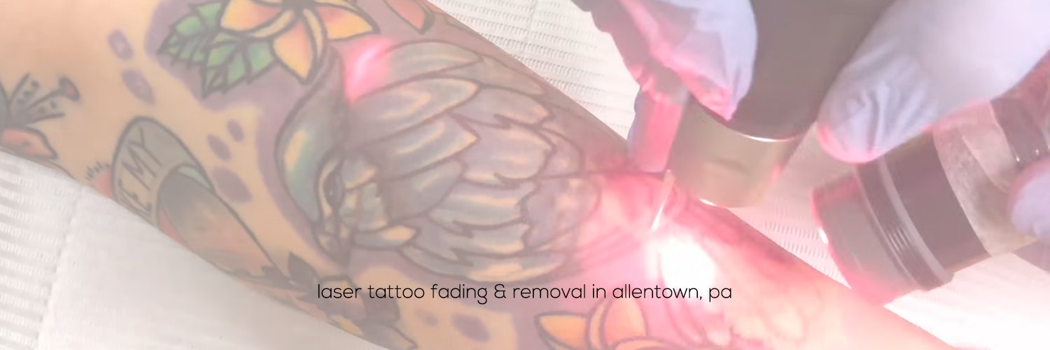 GOTattooRemoval's profile banner image