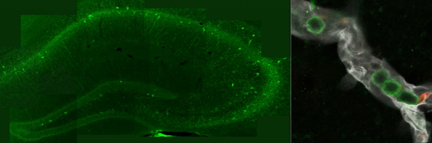 NeuroVascuLab banner