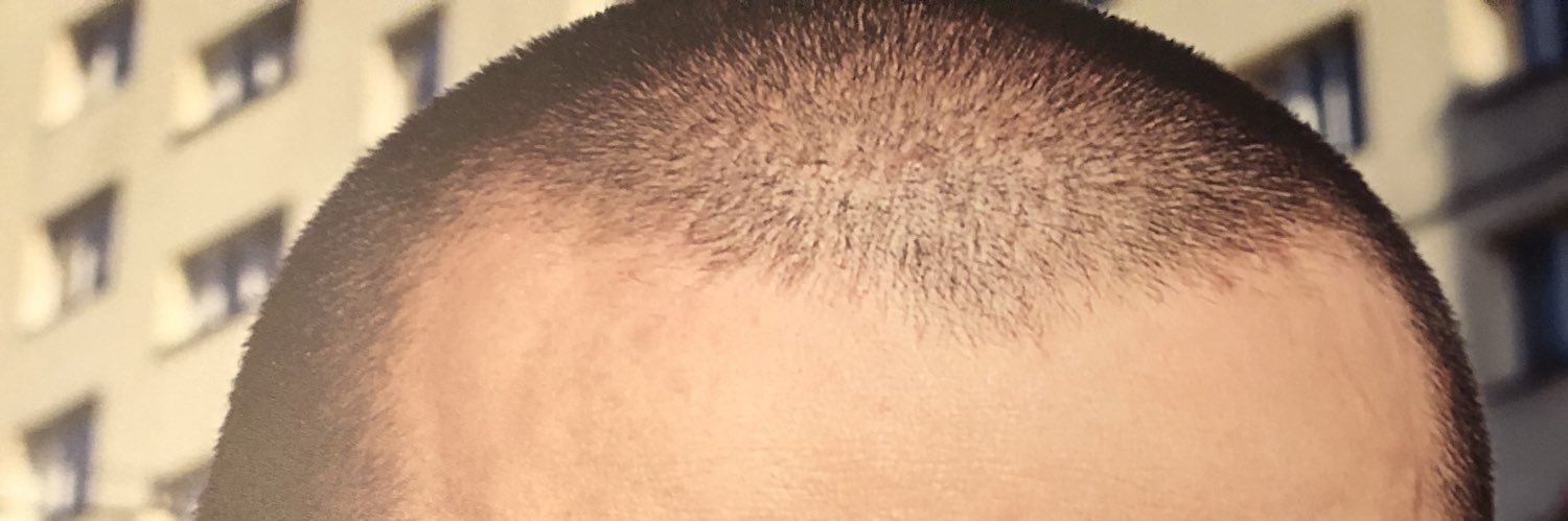 ničiji 🇬🇱🇧🇹 banner
