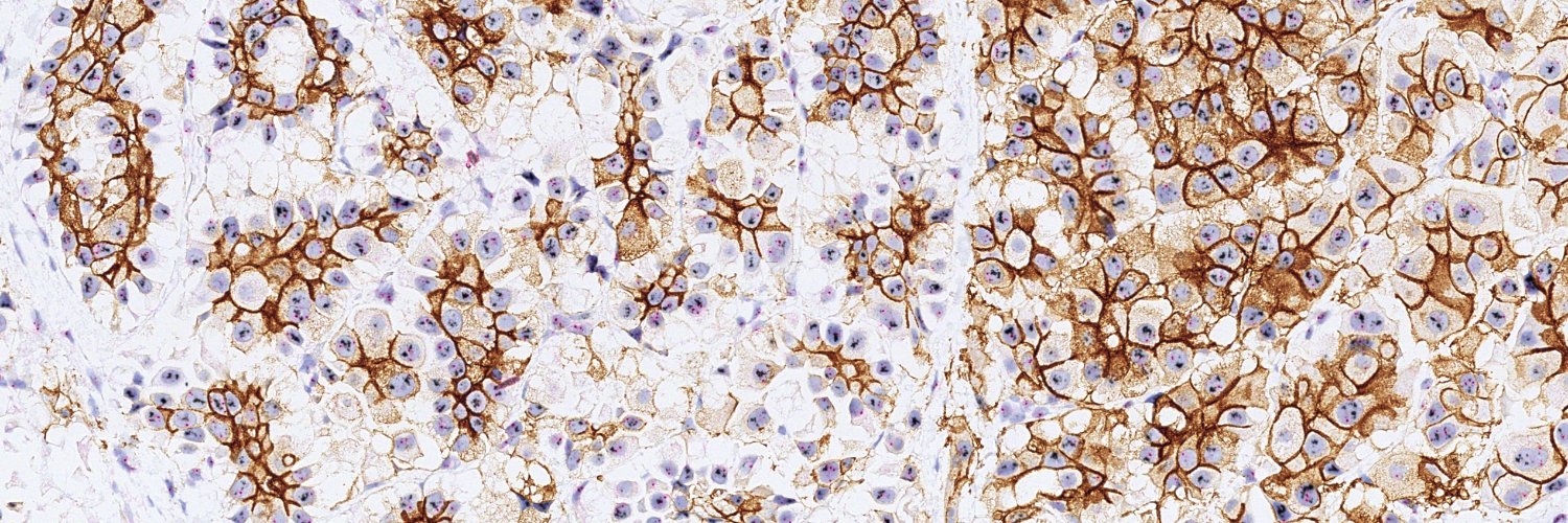 Anna Ehinger, MD 🔬 banner