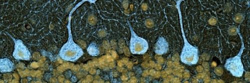 Chelsea E Macpherson, PhD, PT, DPT, NCS banner