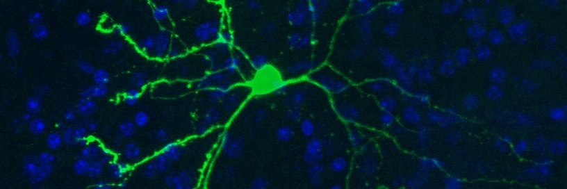 Alessandro Chioino banner