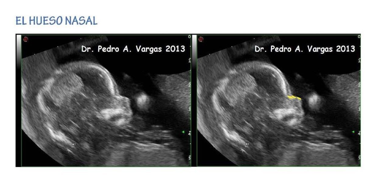 PedroVargasMD's profile banner image