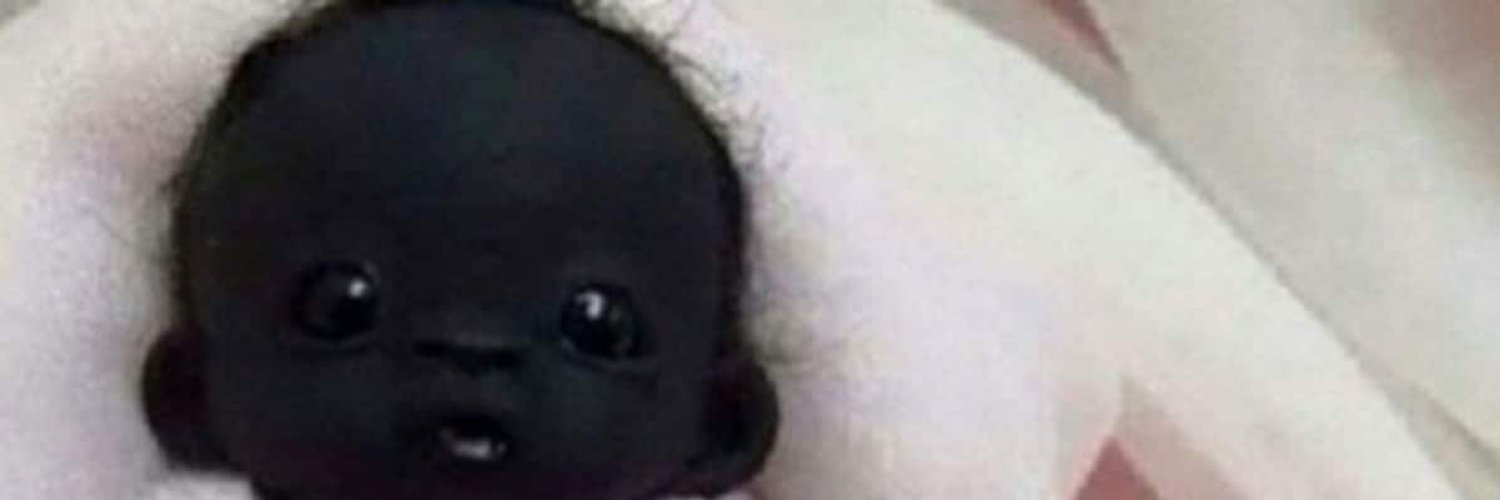 Самый черный ребенок в мире. Дети альбиносы. Синдром ваарденбурга красивые люди. Самый черный ребенок. Самый чёрный негр в мире.