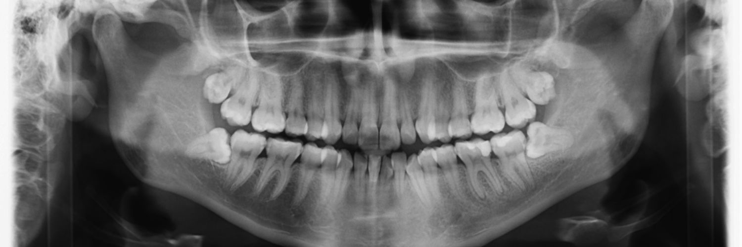 mia (not maya) banner