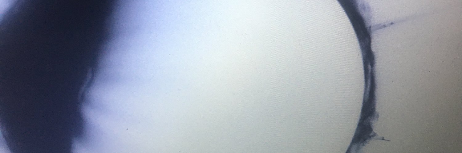 BREAK ALL RECORDS banner