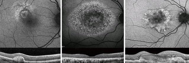 Michalis Georgiou, MD, PhD banner