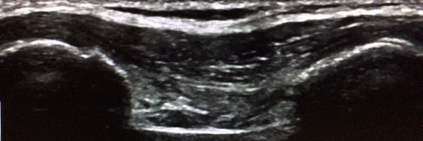 MarlaSammer Profile Banner