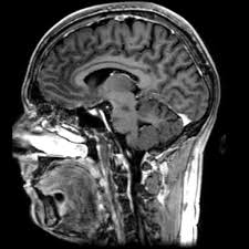 Theo Adu-Bredu banner