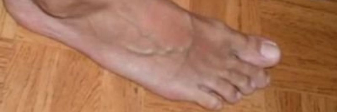 Feet_Bcn banner