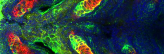 Marrs Laboratory banner