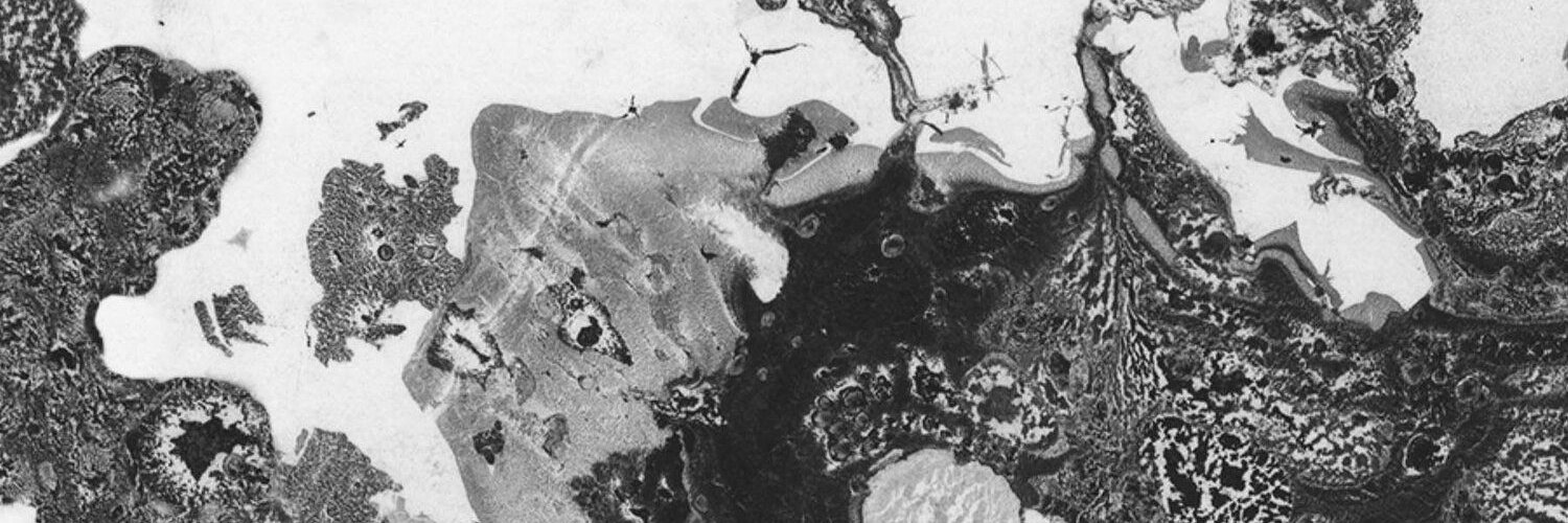 Devoxer banner