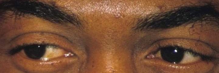 Patrick Alabi banner
