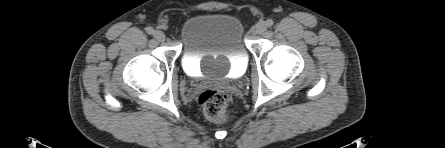 Urólogo Patricio banner