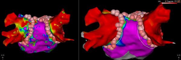 WBallany Profile Banner